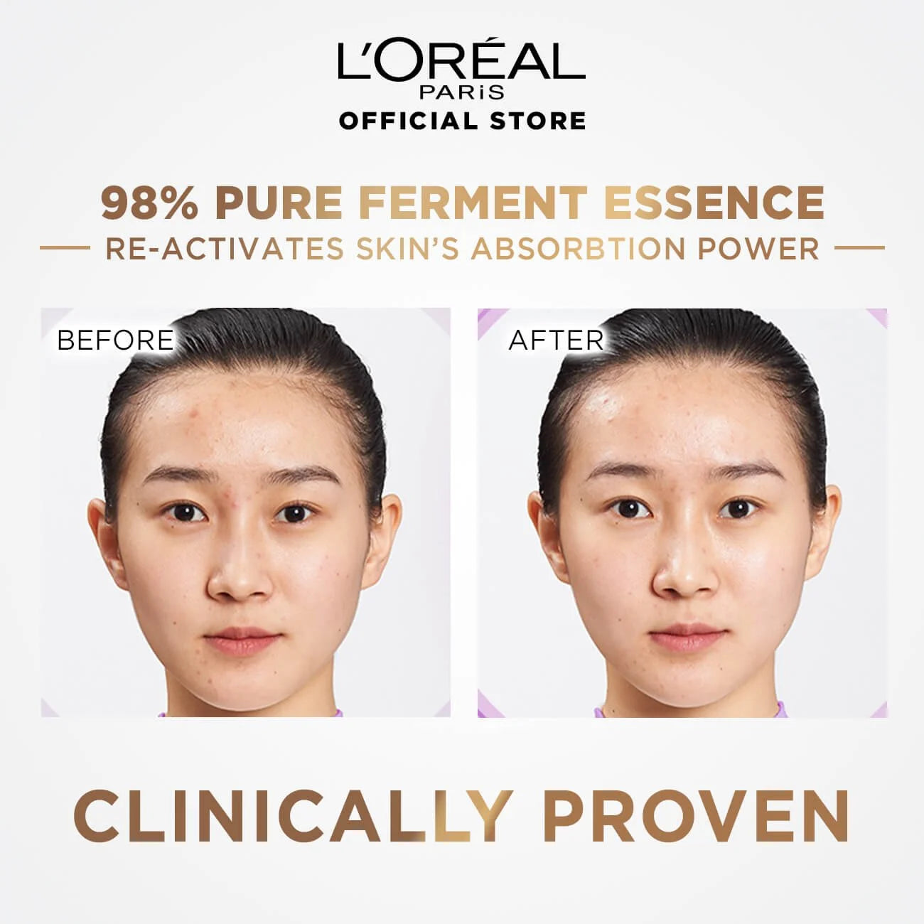 L'Oréal Paris Skin Activating Ferment Pre-Essence