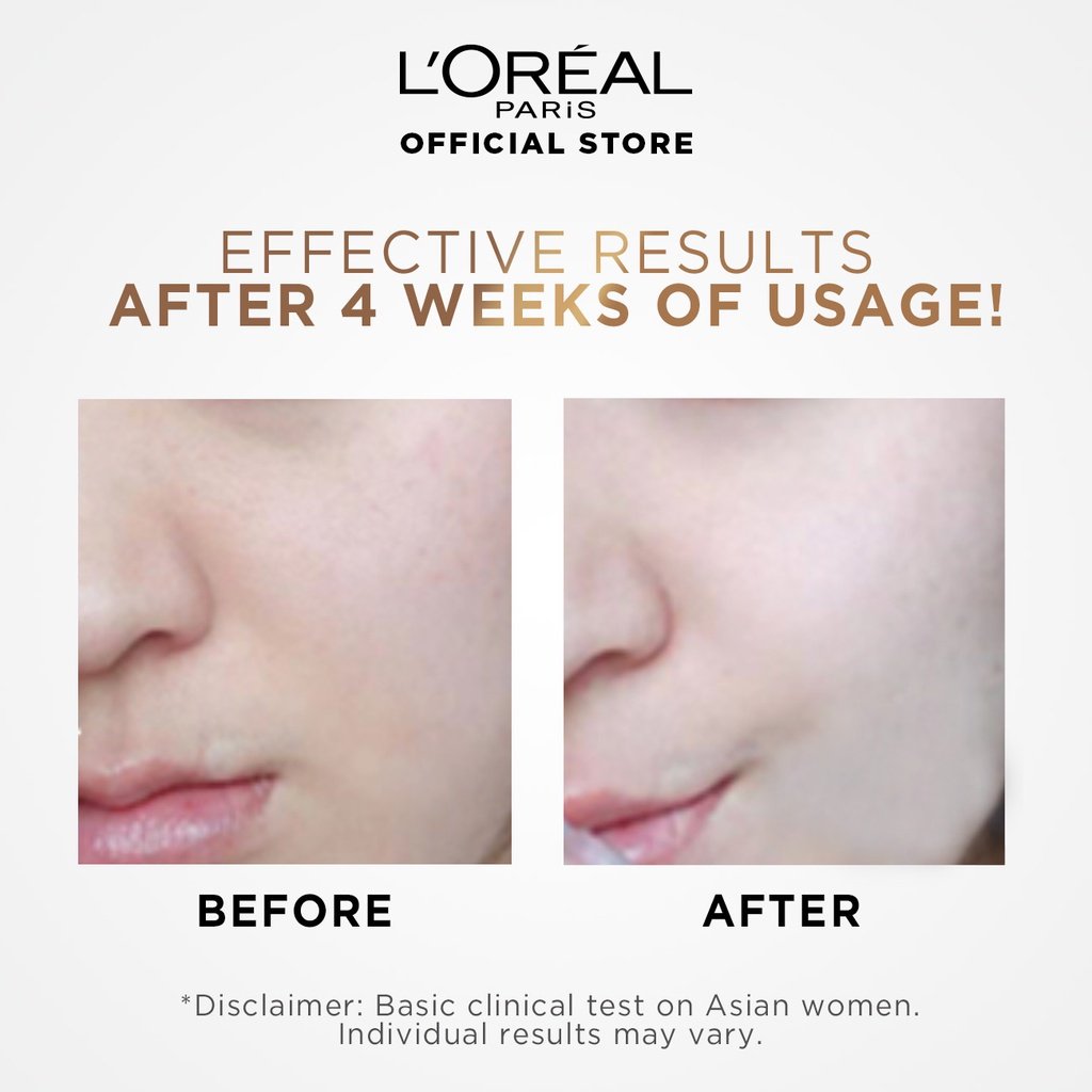 L'Oréal Paris Clinical Derm Aura Serum