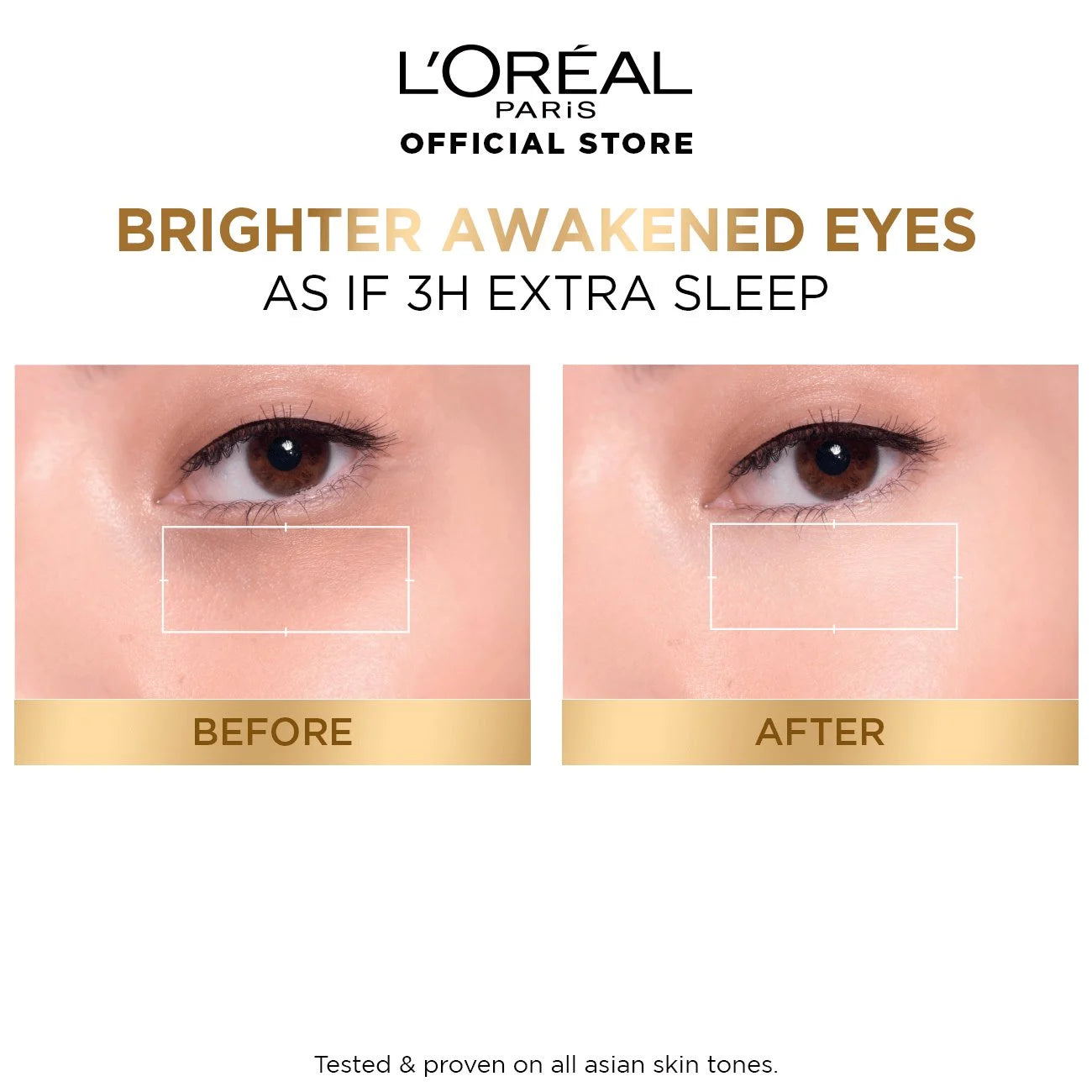 L'Oréal Paris Glycolic Bright Dark Circle Eye Serum